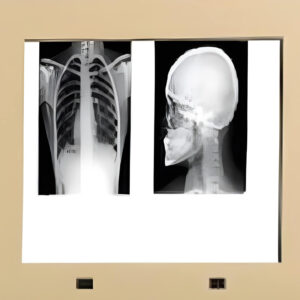 (TH-11-OT) LED X-Ray Viewing Screen